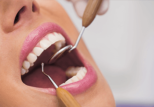 Oral